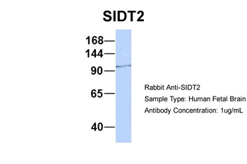 SIDT2 Rabbit Polyclonal Antibody
