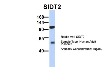 SIDT2 Rabbit Polyclonal Antibody