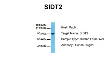 SIDT2 Rabbit Polyclonal Antibody