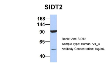 SIDT2 Rabbit Polyclonal Antibody