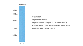 INSIG1 Rabbit Polyclonal Antibody