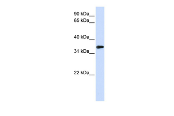 MBD3 Rabbit Polyclonal Antibody