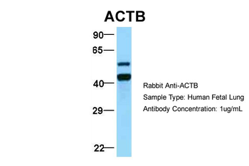 ACTB Rabbit Polyclonal Antibody