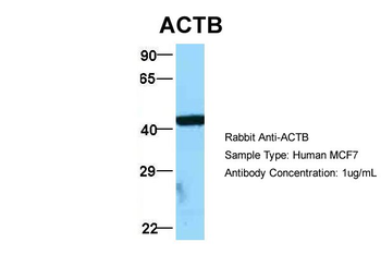 ACTB Rabbit Polyclonal Antibody
