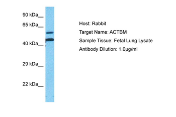 ACTB Rabbit Polyclonal Antibody