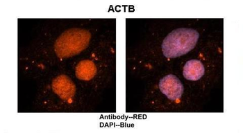 ACTB Rabbit Polyclonal Antibody