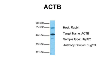 ACTB Rabbit Polyclonal Antibody