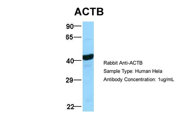 ACTB Rabbit Polyclonal Antibody