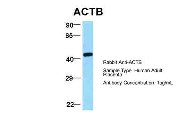 ACTB Rabbit Polyclonal Antibody