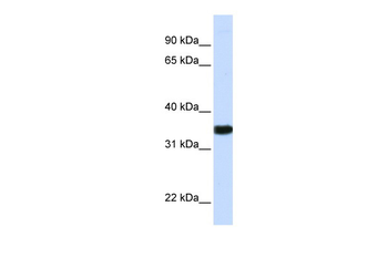 GAPDH Rabbit Polyclonal Antibody