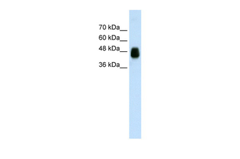 HOMER1 Rabbit Polyclonal Antibody