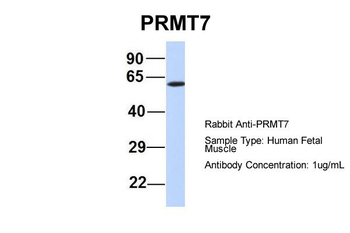 PRMT7 Rabbit Polyclonal Antibody