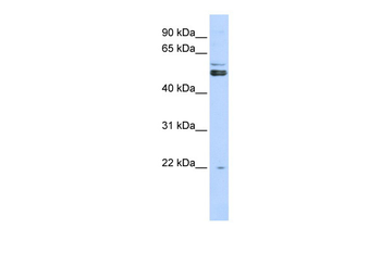 PRMT2 Rabbit Polyclonal Antibody