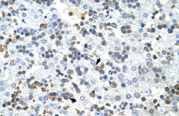 PRMT2 Rabbit Polyclonal Antibody