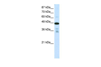 PRMT2 Rabbit Polyclonal Antibody