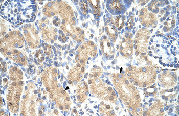 PRMT1 Rabbit Polyclonal Antibody