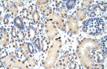 ANP32A Rabbit Polyclonal Antibody