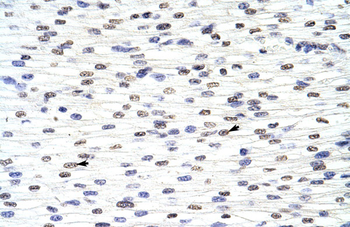 ANP32A Rabbit Polyclonal Antibody