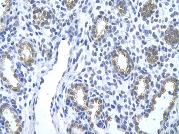 KRT18 Rabbit Polyclonal Antibody