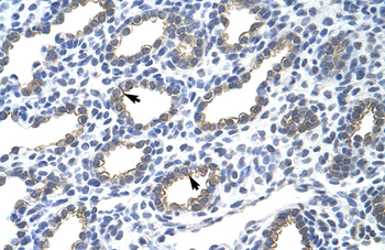 KRT18 Rabbit Polyclonal Antibody