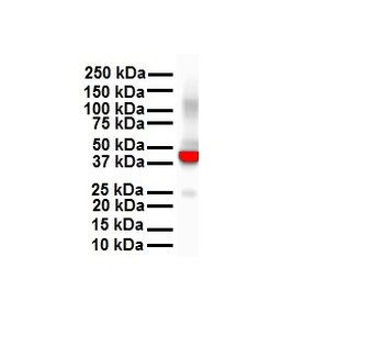 KRT18 Rabbit Polyclonal Antibody