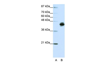 KRT18 Rabbit Polyclonal Antibody