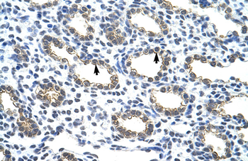 KRT18 Rabbit Polyclonal Antibody