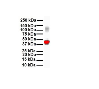 KRT18 Rabbit Polyclonal Antibody
