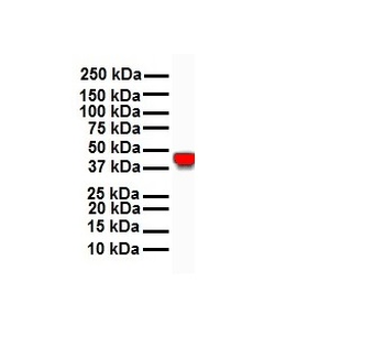 KRT18 Rabbit Polyclonal Antibody