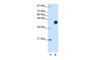 KRT18 Rabbit Polyclonal Antibody