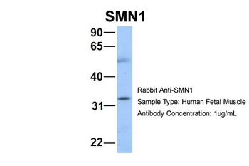 SMN1 Rabbit Polyclonal Antibody