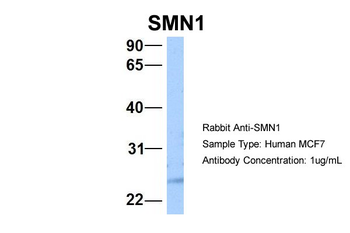 SMN1 Rabbit Polyclonal Antibody