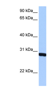SMN1 Rabbit Polyclonal Antibody