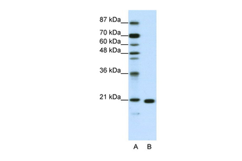 RPL9 Rabbit Polyclonal Antibody