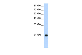 RPL9 Rabbit Polyclonal Antibody