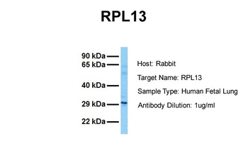 RPL13 Rabbit Polyclonal Antibody