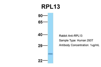 RPL13 Rabbit Polyclonal Antibody