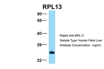 RPL13 Rabbit Polyclonal Antibody