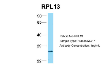 RPL13 Rabbit Polyclonal Antibody