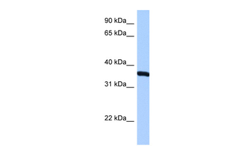 RPLP0 Rabbit Polyclonal Antibody