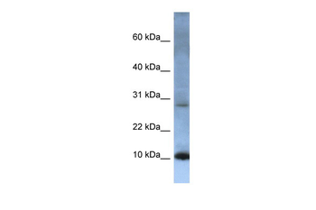 ATP5MC2 Rabbit Polyclonal Antibody
