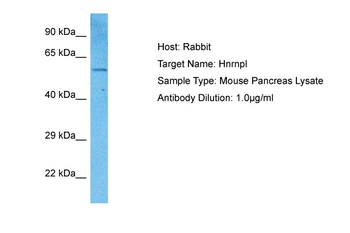 HNRPL Rabbit Polyclonal Antibody