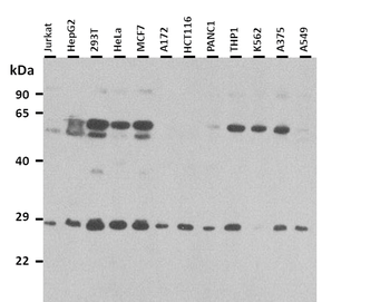 RBPMS Rabbit Polyclonal Antibody