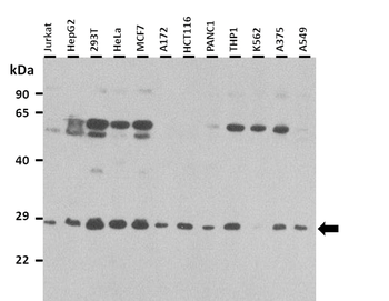 RBPMS Rabbit Polyclonal Antibody