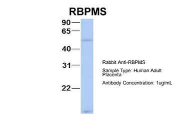 RBPMS Rabbit Polyclonal Antibody