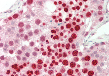 RBPMS Rabbit Polyclonal Antibody