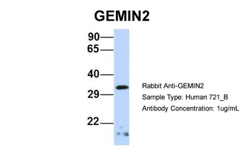 SIP1 Rabbit Polyclonal Antibody
