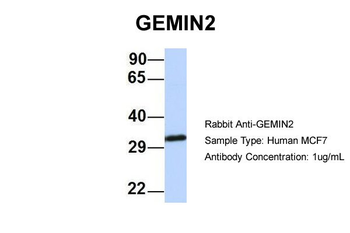 SIP1 Rabbit Polyclonal Antibody