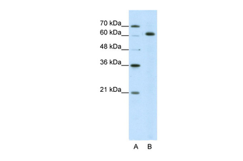 SNRP70 Rabbit Polyclonal Antibody