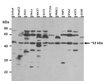 FUS Rabbit Polyclonal Antibody
